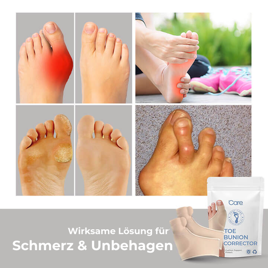 OrthoToe – Spürbare Entlastung für deine Füße!