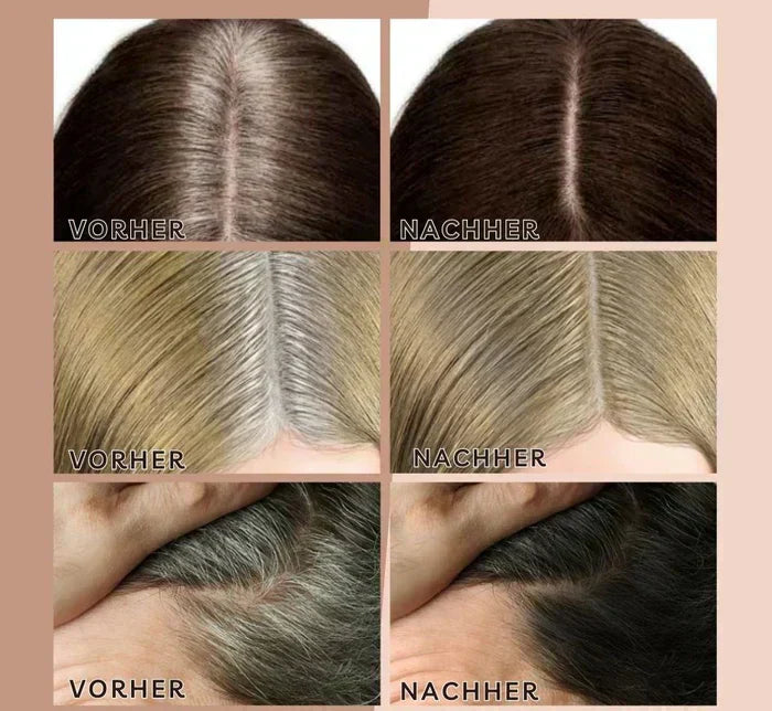 HairHalo – Perfekte Haarlinien jederzeit