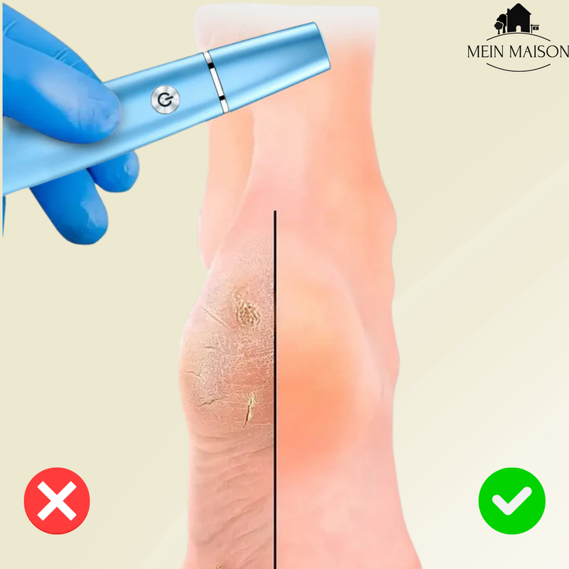 SilkaFeet™ – Mühelos glatte und gepflegte Füße