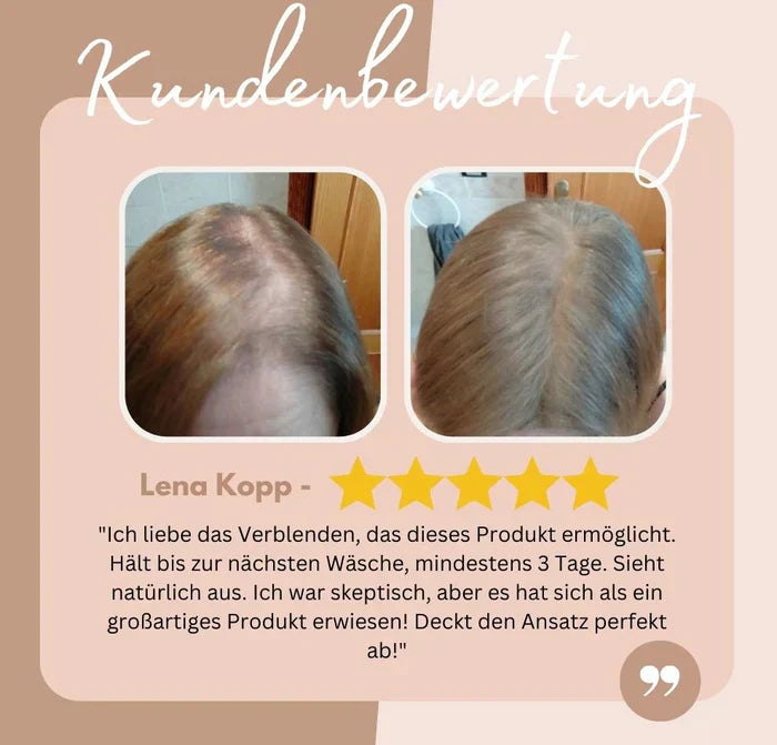 HairHalo – Perfekte Haarlinien jederzeit