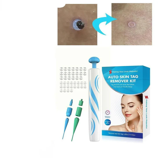 DermaClear Hauttags Entferner | Schmerzfreie Anwendung | Kompakt & Hygienisch | Für Männer & Frauen