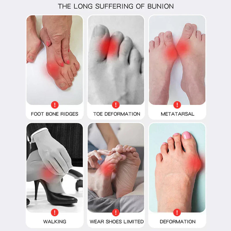 OrthoFlex – Bequemes Gehen mit Hallux-Valgus-Entlastung!