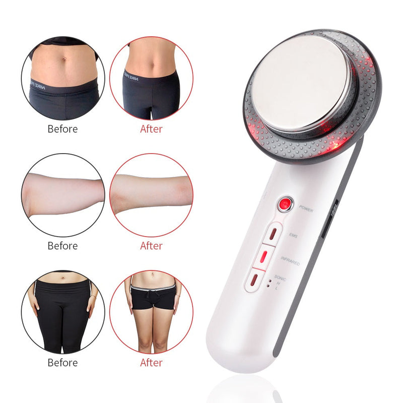 Siluvia Körperstraffer mit EMS & Ultraschall | 3-in-1 Slimming-Massager | Fettverbrennung & Hautstraffung | 5 Intensitätsstufen