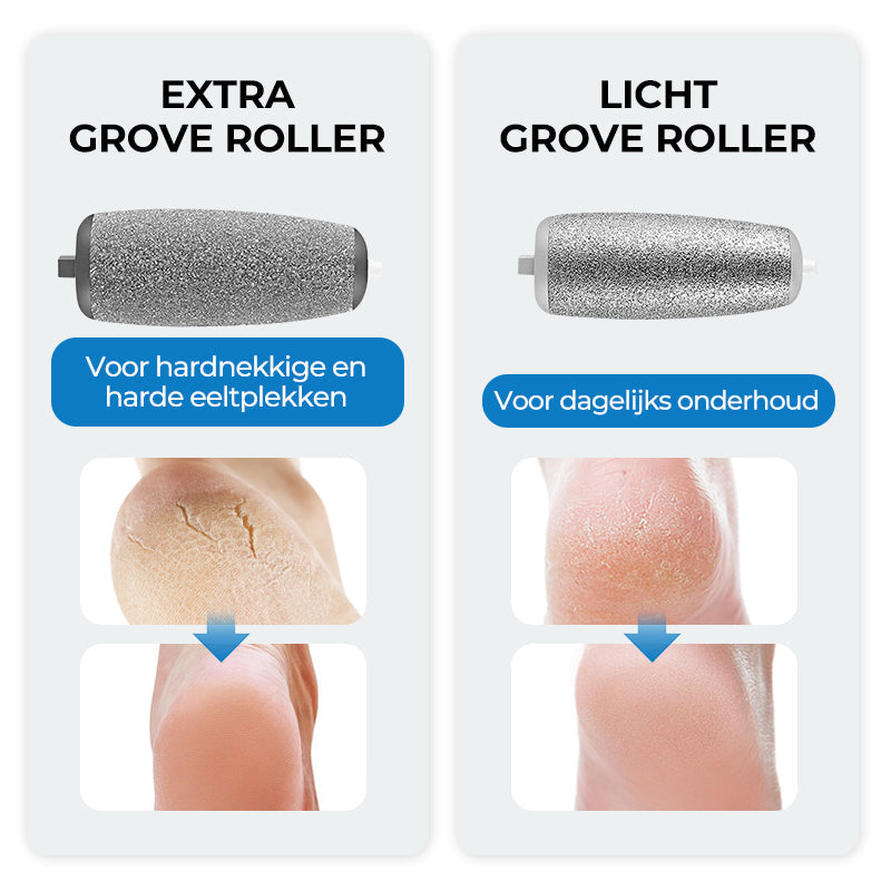 SmoothFoot – Erreichen Sie in nur wenigen Minuten seidig glatte Füße