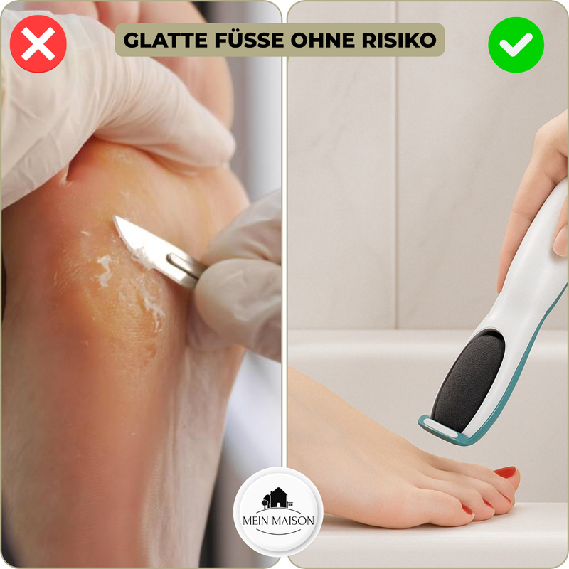 SilkaFeet™ – Mühelos glatte und gepflegte Füße