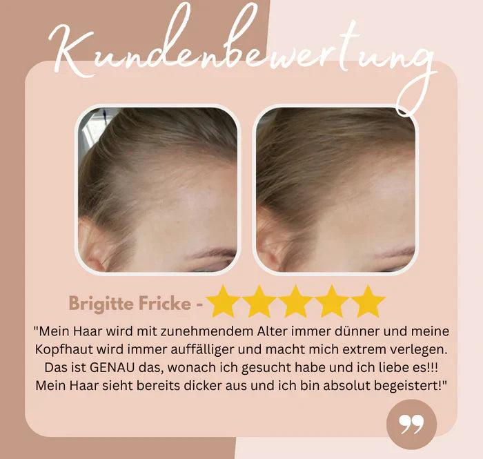 HairHalo – Perfekte Haarlinien jederzeit
