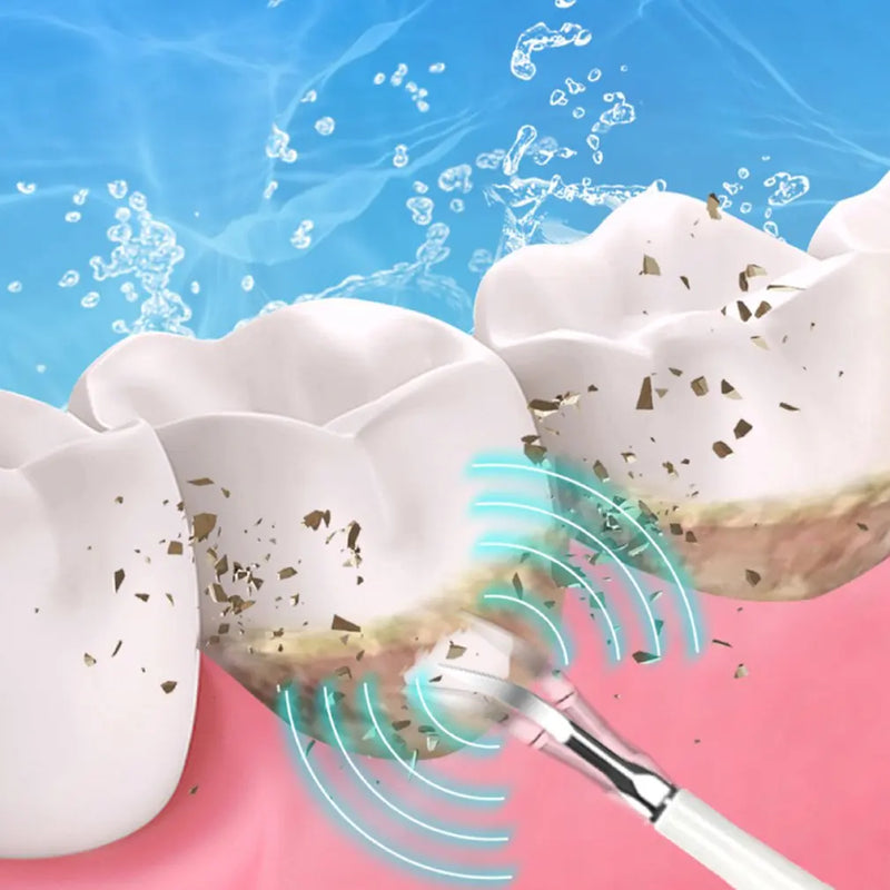 Sonic Zahnreiniger DentaClear Pro | Zahnsteinentferner & Whitening-Irrigator | USB-Aufladung | 21,5 cm