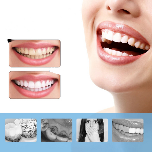 Elektrischer Zahnreiniger Brightic Smile 6-Stufen | Zahnaufhellung & Zahnsteinentferner | IPX6 Wasserdicht | USB-C | 21,5 cm
