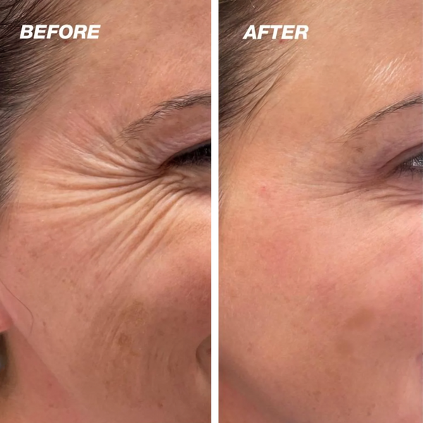 1+1 GRATIS | DermCare SkinGlow – Erreichen Sie perfekt glatte Haut!