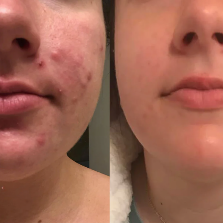 1+1 GRATIS | DermCare SkinGlow – Erreichen Sie perfekt glatte Haut!
