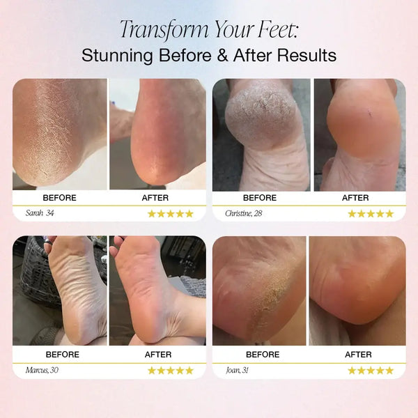 SoftFeet – Seidig glatte Füße in Sekunden!