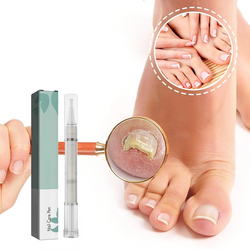 1+1 GRATIS | NailBloom – Sag brüchigen Nägeln für immer Lebewohl