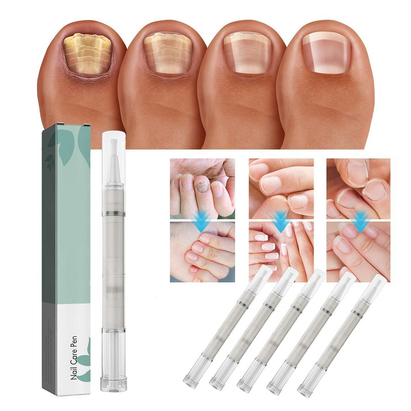 1+1 GRATIS | NailBloom – Sag brüchigen Nägeln für immer Lebewohl