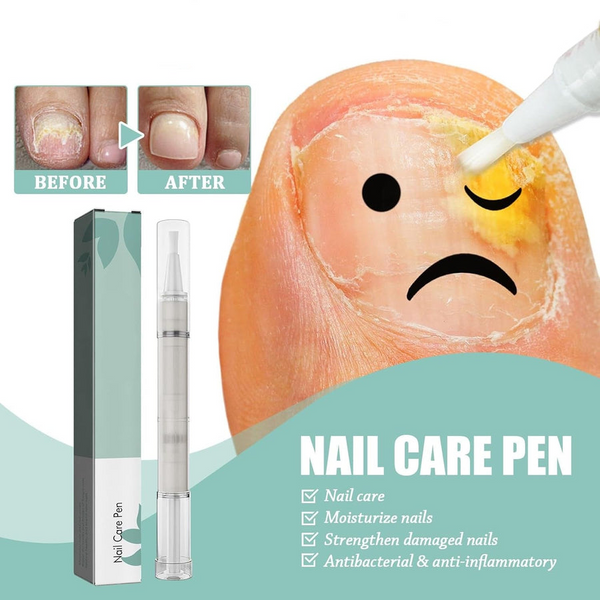 1+1 GRATIS | NailBloom – Sag brüchigen Nägeln für immer Lebewohl