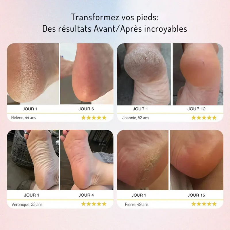 SoftFeet – Seidig glatte Füße in Sekunden!